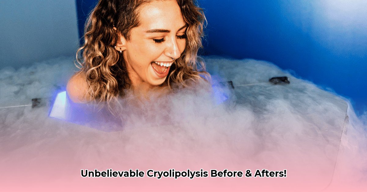 cryotherapy-weight-loss-before-and-after